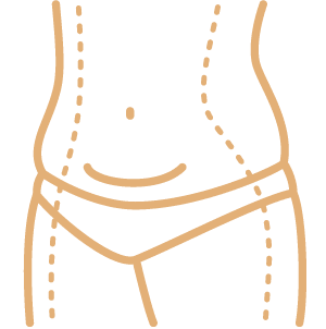 Tummy Tuck