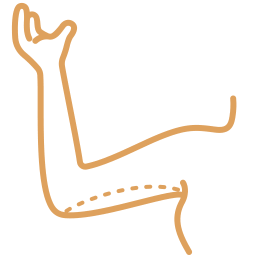 Arm Lift