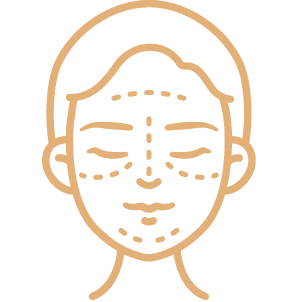 Facelift